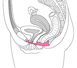Illustration PC-Muskel Frau. Beckenboden Frau
